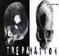 paroles Trepanation