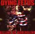 Killing On Adrenaline - Dying Fetus